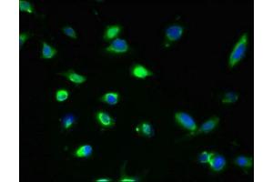 Immunofluorescent analysis of U251 cells using ABIN7154172 at dilution of 1:100 and Alexa Fluor 488-congugated AffiniPure Goat Anti-Rabbit IgG(H+L)