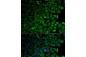 Immunofluorescence analysis of HeLa cells using CD1D Polyclonal Antibody (CD1d anticorps)