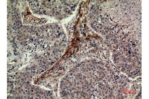 Immunohistochemistry (IHC) analysis of paraffin-embedded Human Lung, antibody was diluted at 1:100. (IDH1 anticorps  (N-Term))