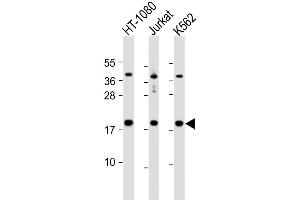 Western Blot at 1:1000 dilution Lane 1: HT-1080 whole cell lysate Lane 2: Jurkat whole cell lysate Lane 3: K562 whole cell lysate Lysates/proteins at 20 ug per lane.