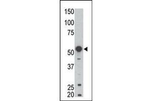 Western blot analysis of anti-BLK Pab (ABIN392087 and ABIN2841844) in mouse kidney tissue lysate.