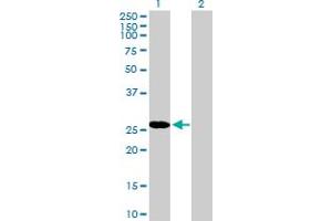 Western Blot analysis of RBPMS expression in transfected 293T cell line by RBPMS MaxPab polyclonal antibody. (RBPMS anticorps  (AA 1-219))