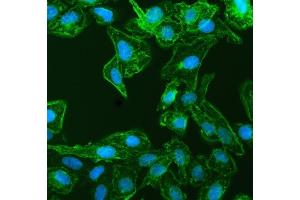 IF analysis of EPLIN/LIMA1 using anti-EPLIN/LIMA1 antibody (ABIN7602639).