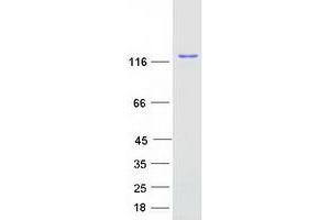 Validation with Western Blot