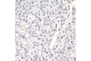 Immunohistochemistry (IHC) image for anti-Zinc Finger E-Box Binding Homeobox 1 (ZEB1) (AA 1074-1124) antibody (ABIN7448887)
