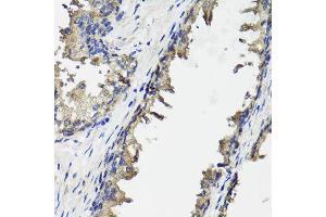 Immunohistochemistry of paraffin-embedded human prostate using OTC antibody at dilution of 1:100 (x40 lens). (OTC anticorps)