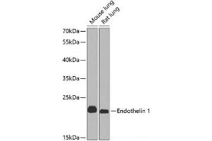Western blot analysis of extracts of various cell lines using Endothelin 1 Polyclonal Antibody at dilution of 1:1000. (Endothelin 1 anticorps)