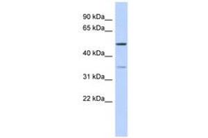 Image no. 1 for anti-Cholesteryl Ester Transfer Protein (CETP) (AA 395-444) antibody (ABIN6743589) (CETP anticorps  (AA 395-444))