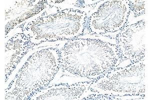 ABIN6257570 and ABIN6273546 at 1/100 staining Rat testis tissue by IHC-P. (ZNF497 anticorps  (N-Term))