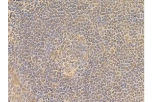ABIN7095684 and ABIN7099746 at 1/100 staining human normal tonsil tissue by IHC-P. (KLHL26 anticorps)