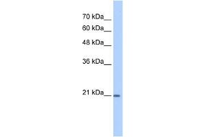 WB Suggested Anti-PTGDS Antibody Titration:  1 ug/ml  Positive Control:  HepG2 cell lysate