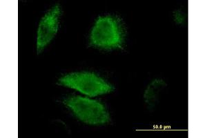 Immunofluorescence of monoclonal antibody to DUSP6 on HeLa cell.