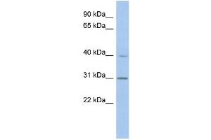 WB Suggested Anti-PERLD1 Antibody Titration:  0. (PGAP3 anticorps  (N-Term))