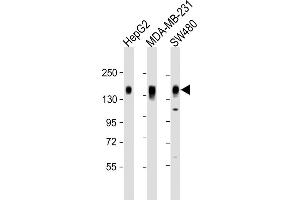 All lanes : Anti-C Antibody (C-term) at 1:2000 dilution Lane 1: HepG2 whole cell lysate Lane 2: MDA-MB-231 whole cell lysate Lane 3: S whole cell lysate Lysates/proteins at 20 μg per lane. (CD130/gp130 anticorps  (C-Term))