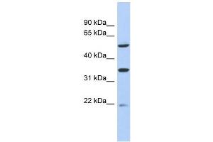 MGC34821 antibody used at 1 ug/ml to detect target protein. (MGC34821 (Middle Region) anticorps)