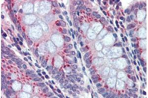 anti-beta-Site APP-Cleaving Enzyme 2 (BACE2) (C-Term) antibody