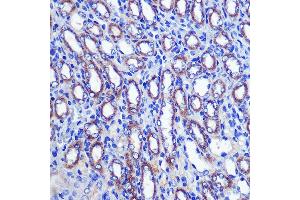 Immunohistochemistry of paraffin-embedded Mouse kidney using LETMD1 Rabbit pAb (ABIN3023040, ABIN3023041, ABIN3023042, ABIN1513151 and ABIN6219360) at dilution of 1:100 (40x lens). (LETMD1 anticorps  (AA 161-360))