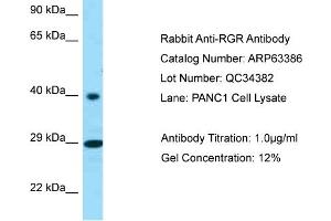 Western Blotting (WB) image for anti-Retinal G Protein Coupled Receptor (RGR) (C-Term) antibody (ABIN971566) (RGR anticorps  (C-Term))