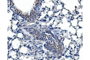 IHC analysis of Adam28 using anti-Adam28 antibody (ABIN7600945). (ADAM28 anticorps  (AA 26-195))