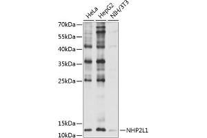Western blot analysis of extracts of various cell lines, using NHP2L1 antibody (ABIN6132411, ABIN6144624, ABIN6144625 and ABIN6221625) at 1:1000 dilution. (NHP2L1 anticorps  (AA 1-128))