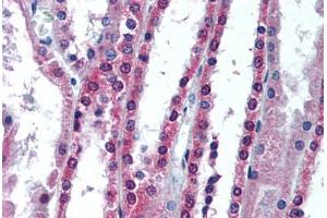 Human Kidney (formalin-fixed, paraffin-embedded) stained with APIP antibody ABIN292116 at 10 ug/ml followed by biotinylated goat anti-rabbit IgG secondary antibody ABIN481713, alkaline phosphatase-streptavidin and chromogen. (APIP anticorps)
