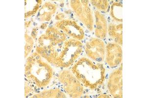 Immunohistochemistry of paraffin-embedded human kidney using PDE4DIP antibody at dilution of 1:100 (40x lens). (PDE4DIP anticorps)