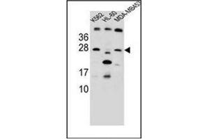 Western blot analysis of DKK4 Antibody (C-term) in K562,HL-60, MDA-MB453 cell line lysates (35ug/lane). (DKK4 anticorps  (C-Term))