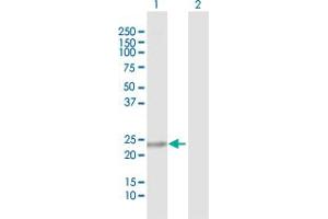 Western Blot analysis of C9orf95 expression in transfected 293T cell line by C9orf95 MaxPab polyclonal antibody. (NMRK1 anticorps  (AA 1-199))