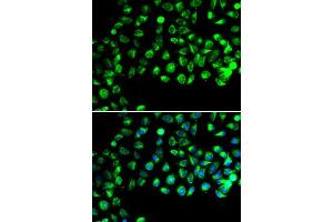 Immunofluorescence analysis of A549 cells using C16orf80 antibody. (C16orf80 anticorps  (AA 1-193))