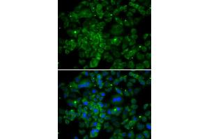 Immunofluorescence analysis of MCF7 cell using CCL2 antibody. (CCL2 anticorps)