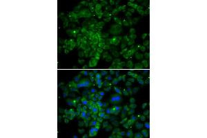 Immunofluorescence analysis of MCF7 cell using CCL2 antibody. (CCL2 anticorps)