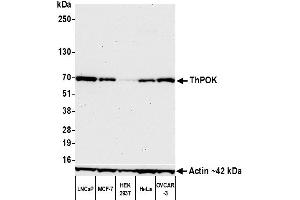 Western Blotting (WB) image for anti-ThPok (AA 250-300) antibody (ABIN7455169) (Recombinant ThPok (AA 250-300) anticorps)