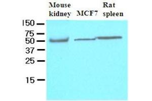 Cell lysates of mouse kidney, MCF7 and rat spleen (40 ug) were resolved by SDS-PAGE, transferred to nitrocellulose membrane and probed with anti-human FLIP (1:500). (FLIP anticorps  (AA 1-376))
