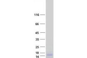 Validation with Western Blot (RPL19 Protein (Myc-DYKDDDDK Tag))