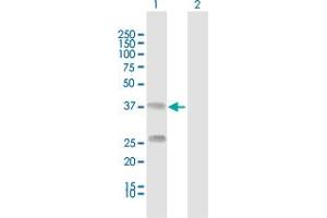 Western Blot analysis of C4BPB expression in transfected 293T cell line by C4BPB MaxPab polyclonal antibody. (C4BPB anticorps  (AA 1-252))