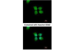 ICC/IF Image Immunofluorescence analysis of paraformaldehyde-fixed A431, using ORC4L, antibody at 1:500 dilution.