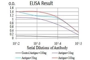 Black line: Control Antigen (100 ng),Purple line: Antigen (10 ng), Blue line: Antigen (50 ng), Red line:Antigen (100 ng)