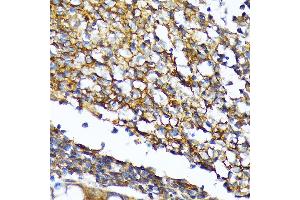 Immunohistochemistry of paraffin-embedded human colon using CD82 Rabbit mAb (ABIN7266222) at dilution of 1:100 (40x lens).