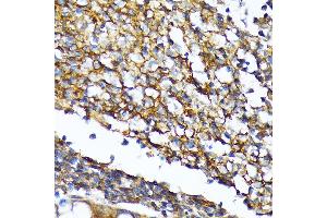 Immunohistochemistry of paraffin-embedded human colon using CD82 Rabbit mAb (ABIN7266222) at dilution of 1:100 (40x lens). (CD82 anticorps)