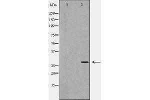 Western blot analysis of VEGF expression in A431 cells,The lane on the left is treated with the antigen-specific peptide. (VEGFA anticorps  (Internal Region))