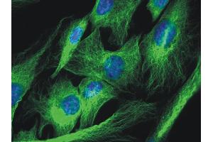 Immunocytochemistry staining of 3T3 mouse embryonal fibroblast cell line using anti-alpha-tubulin (TU-01, green).