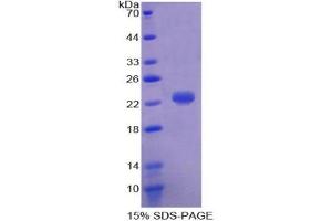 SDS-PAGE of Protein Standard from the Kit (Highly purified E.