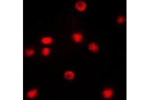 Immunofluorescent analysis of C/EBP zeta staining in COLO205 cells. (DDIT3 anticorps  (N-Term))