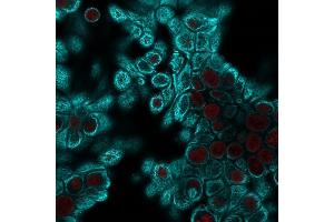 anti-Keratin 126 Pseudogene (KRT126P) antibody