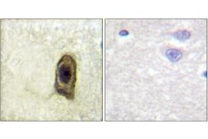 Immunohistochemical analysis of paraffin-embedded human brain, using CSFR (Phospho-Tyr561) antibody (left)or the same antibody preincubated with blocking peptide (right). (CSF1R anticorps  (pTyr561))