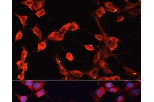 Immunofluorescence analysis of NIH-3T3 cells using ADAMTS13 Polyclonal Antibody at dilution of 1:100 (40x lens).