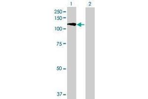 Lane 1: KIAA1199 transfected lysate ( 110. (KIAA1199 293T Cell Transient Overexpression Lysate(Denatured))