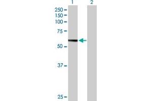 Western Blot analysis of HEXB expression in transfected 293T cell line by HEXB MaxPab polyclonal antibody. (HEXB anticorps  (AA 1-556))