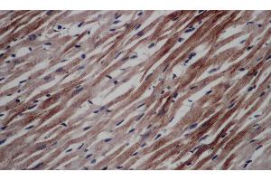 Immunohistochemistry of paraffin-embedded Rat heart using CD297 Polyclonal Antibody at dilution of 1:50