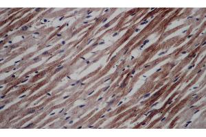 Immunohistochemistry of paraffin-embedded Rat heart using CD297 Polyclonal Antibody at dilution of 1:50 (ART4 anticorps)